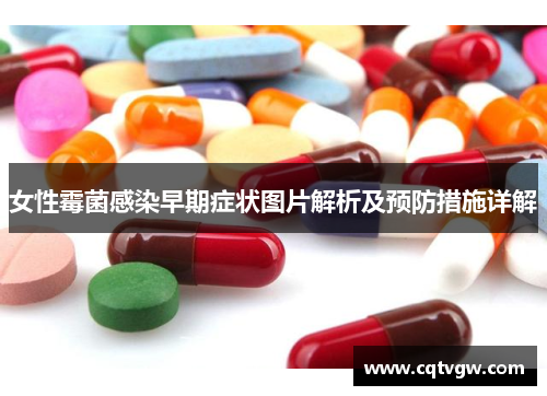 女性霉菌感染早期症状图片解析及预防措施详解 女性霉菌感染早期症状图片解析及预防措施详解